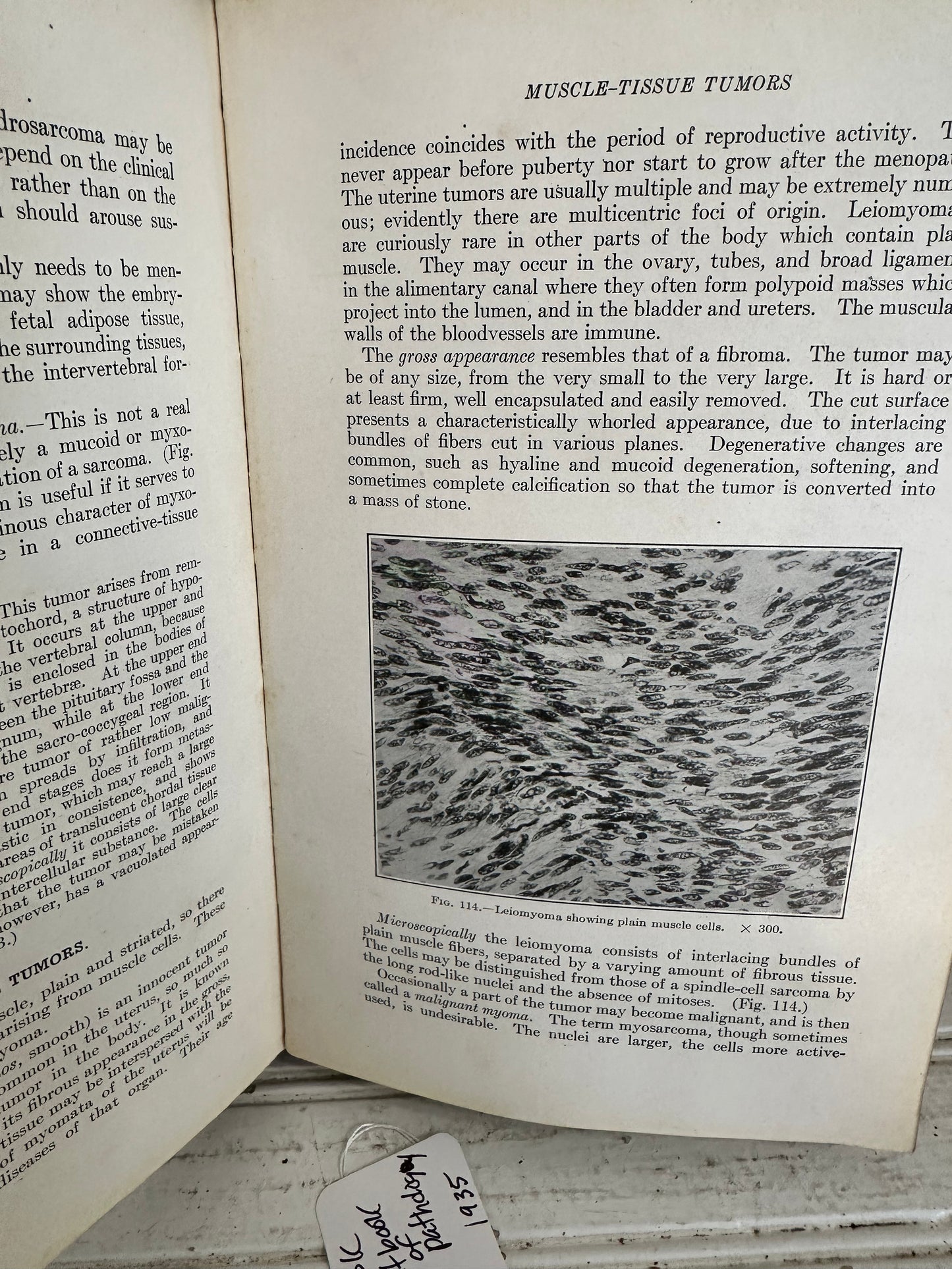 Text book of Pathology